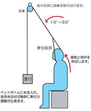 頚椎装具イラスト